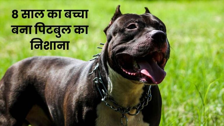 Noida: Pitbull ने 8 साल के बच्चे को नोचा, पैर और पेट पर गंभीर घाव